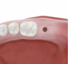 02. 통증 염려 줄임